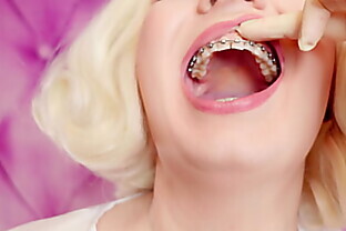 Latex Medical Gloves and Eating Ice Cream (Food Fetish) with Braces (Arya Grander)